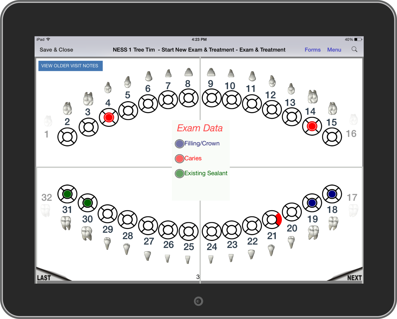 Dental charting screenshot